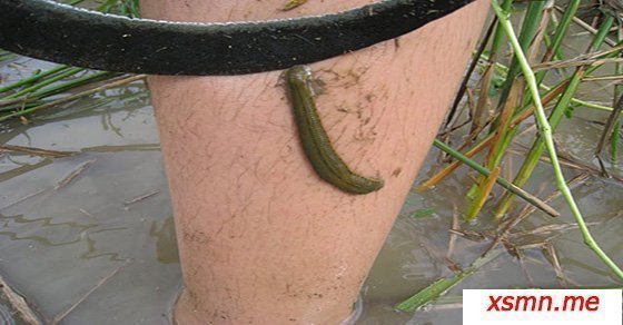 Mơ thấy đỉa bám chân