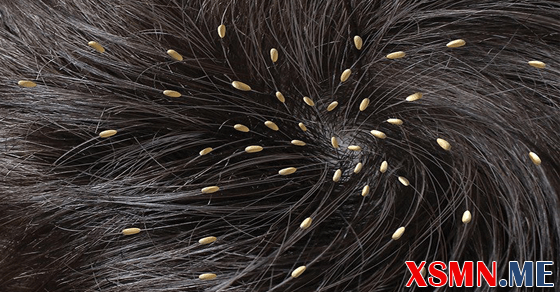 Mơ thấy chấy là may hay xui?